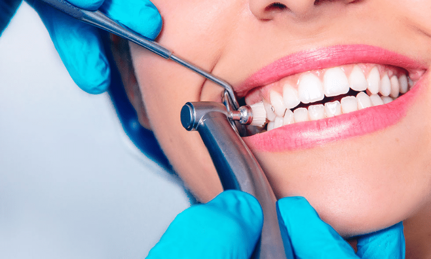 5 Reasons Why Professional Teeth Cleaning Is Important