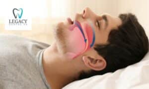 What Is Inspire Therapy For Sleep Apnea?