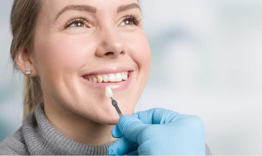 Porcelain Veneers