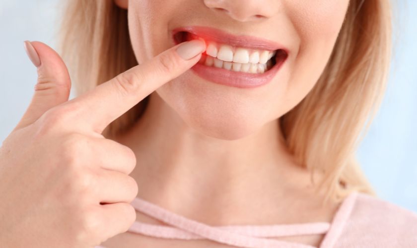 Periodontal Disease