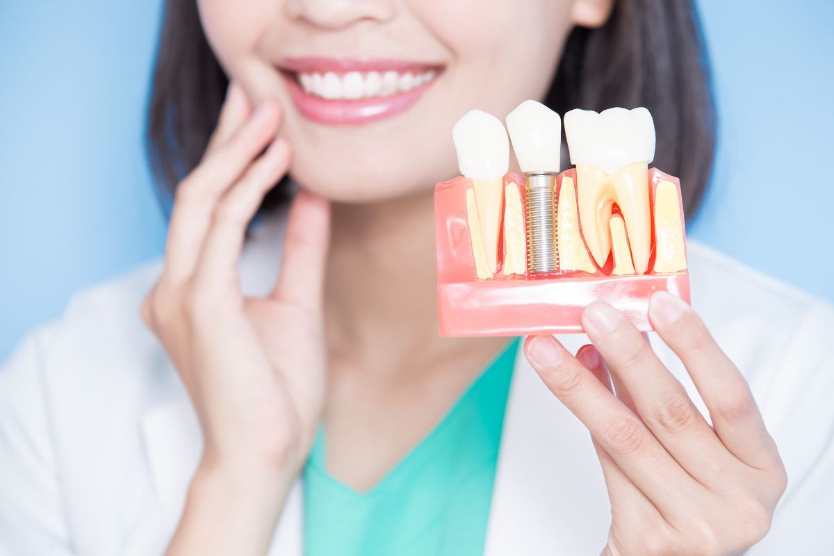 How Long Do Dental Implants Last