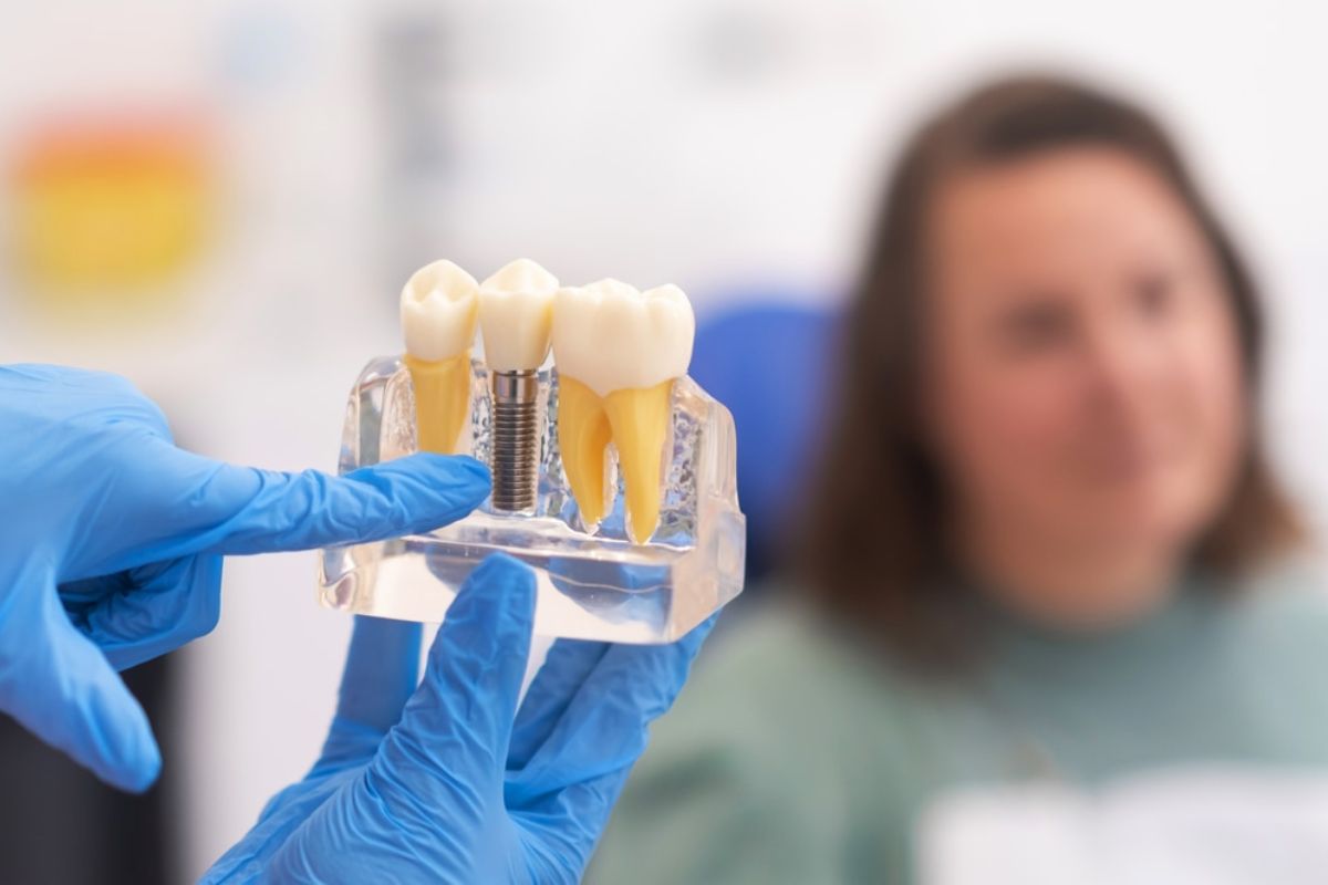 are dental implants painful
