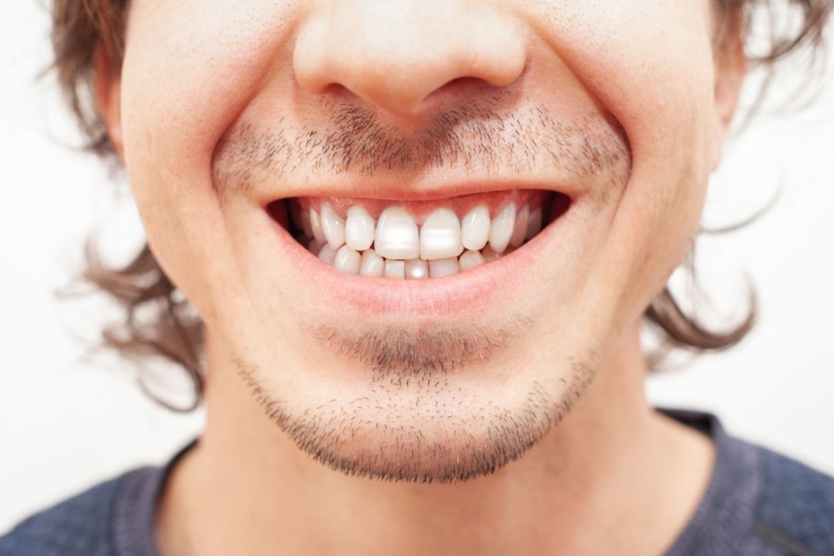 Get Rid of White Spots on Teeth